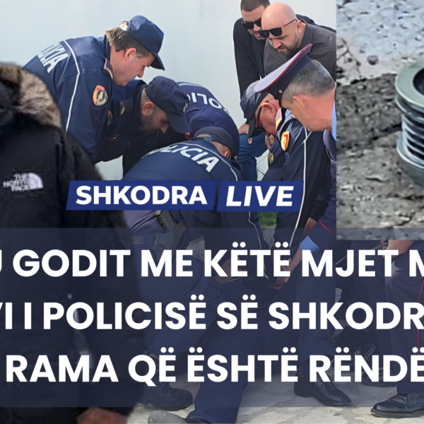 Ja se si u godit në kokë me një mjet&hellip;